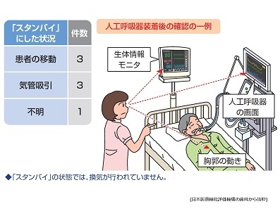 人工呼吸器のスタンバイ状態 解除忘れに注意を医療機能評価機構 メディカルサポネット